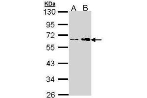 WB Image Sample (30 ug of whole cell lysate) A: H1299 B: Hela 10% SDS PAGE antibody diluted at 1:1000 (Fukutin 抗体)