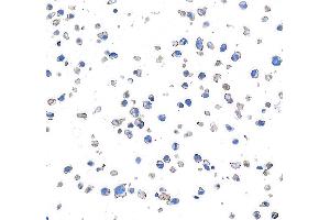 Immunocytochemistry (ICC) image for anti-CD28 (CD28) (AA 170-220) antibody (ABIN7455122) (Recombinant CD28 抗体  (AA 170-220))