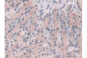 IHC-P analysis of Rat Stomach Tissue, with DAB staining. (Glucocorticoid Receptor 抗体  (AA 564-733))