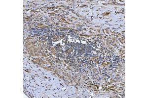 IHC analysis of SLC9A3R2 using anti-SLC9A3R2 antibody (ABIN7599271).