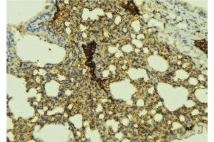Immunohistochemistry (IHC) image for anti-ATP-Binding Cassette, Sub-Family C (CFTR/MRP), Member 1 (ABCC1) (N-Term) antibody (ABIN6266183)