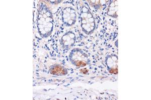 Immunohistochemistry of paraffin-embedded Human colon using SMYD3 Rabbit pAb (ABIN7270260) at dilution of 1:100 (40x lens). (SMYD3 抗体  (AA 50-150))
