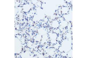 Immunohistochemistry of paraffin-embedded mouse lung using THRA Rabbit pAb (ABIN6128827, ABIN6149127, ABIN7101779 and ABIN7101780) at dilution of 1:50 (40x lens). (THRA 抗体  (AA 100-200))