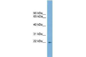 WB Suggested Anti-Rgs10 Antibody Titration: 0.