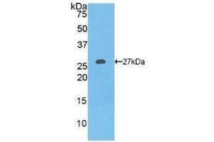 Detection of Recombinant COL1a1, Human using Polyclonal Antibody to Collagen Type I Alpha 1 (COL1a1) (COL1A1 抗体  (AA 253-471))