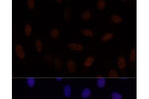 Immunofluorescence analysis of U-2 OS cells using GLI2 Polyclonal Antibody at dilution of 1:100. (GLI2 抗体)