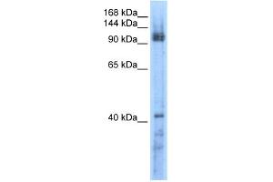 WB Suggested Anti-RECQL5 Antibody Titration:  0. (RECQL5 抗体  (Middle Region))