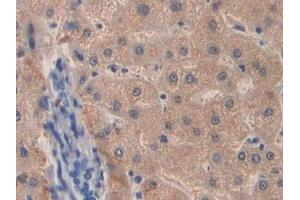 Detection of F8 in Human Liver Tissue using Polyclonal Antibody to Coagulation Factor VIII (F8) (Factor VIII 抗体  (AA 2253-2346))