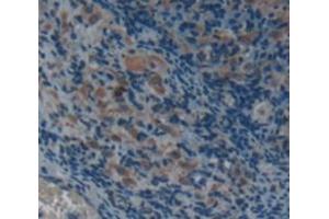 Figure. (alpha 2 Macroglobulin 抗体  (AA 818-1048))