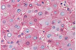 Human Liver (formalin-fixed, paraffin-embedded) stained with Albumin antibody ABIN291153 at 5 ug/ml followed by biotinylated anti-mouse IgG secondary antibody ABIN481714, alkaline phosphatase-streptavidin and chromogen. (Albumin 抗体)