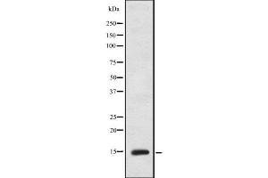 Western blot analysis FABP3 using MCF7 whole cell lysates