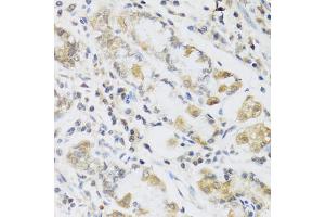 Immunohistochemistry of paraffin-embedded human stomach using RETN antibody (ABIN5974977) at dilution of 1/100 (40x lens). (Resistin 抗体)