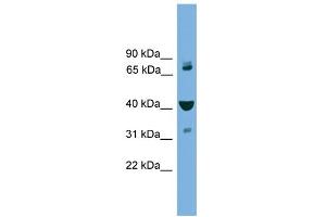 WB Suggested Anti-VPS16 Antibody Titration: 0. (VPS16 抗体  (Middle Region))