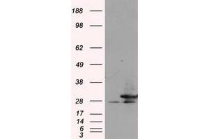 Image no. 3 for anti-Replication Protein A2, 32kDa (RPA2) antibody (ABIN1500739) (RPA2 抗体)