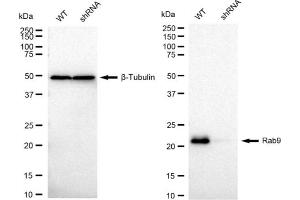 Western blotting analysis using Rab9 antibody (ABIN7800109). (Recombinant RAB9A 抗体)