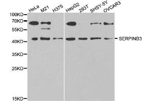 Western Blotting (WB) image for anti-serpin Peptidase Inhibitor, Clade B (Ovalbumin), Member 3 (SERPINB3) antibody (ABIN1876606) (SERPINB3 抗体)