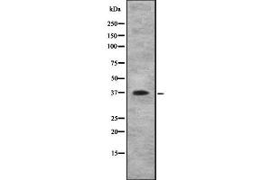 Western blot analysis IL10RB using COLO205 whole cell lysates (IL10RB 抗体  (C-Term))
