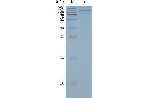 SDS-PAGE (SDS) image for Transient Receptor Potential Cation Channel, Subfamily A, Member 1 (TRPA1) protein (ABIN7491751)
