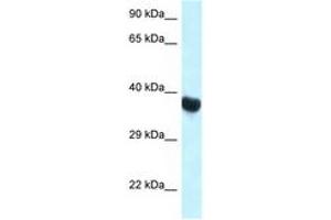 Image no. 1 for anti-Homeobox A10 (HOXA10) (C-Term) antibody (ABIN6747342) (HOXA10 抗体  (C-Term))
