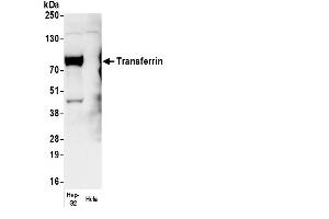 Western Blotting (WB) image for anti-Transferrin (TF) antibody (Biotin) (ABIN7449348)