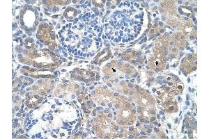 SARDH antibody was used for immunohistochemistry at a concentration of 4-8 ug/ml to stain Epithelial cells of renal tubule (arrows) in Human Kidney. (SARDH 抗体  (Middle Region))
