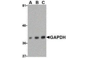 Western Blotting (WB) image for anti-Glyceraldehyde-3-Phosphate Dehydrogenase (GAPDH) (C-Term) antibody (ABIN2473758) (GAPDH 抗体  (C-Term))