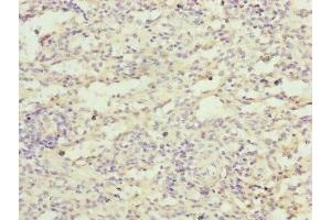 Immunohistochemistry of paraffin-embedded human spleen tissue using ABIN7152484 at dilution of 1:100 (FBXL5 抗体  (AA 1-310))