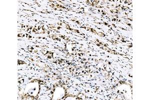 IHC analysis of RRS1 using anti-RRS1 antibody (ABIN7601344). (RRS1 抗体  (AA 33-266))