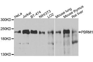 Western blot analysis of extracts of various cell lines, using PBRM1 antibody. (Polybromo 1 抗体)