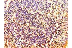 Immunohistochemistry of paraffin-embedded human tonsil tissue using ABIN7155713 at dilution of 1:100 (HOXA2 抗体  (AA 26-124))