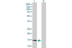 Western Blot analysis of RARRES2 expression in transfected 293T cell line by RARRES2 MaxPab polyclonal antibody. (Chemerin 抗体  (AA 1-163))