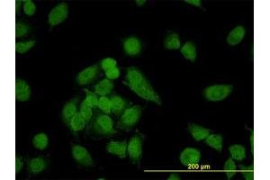 Image no. 4 for anti-Non-SMC Condensin I Complex, Subunit D2 (NCAPD2) (AA 1240-1339) antibody (ABIN599100) (NCAPD2 抗体  (AA 1240-1339))