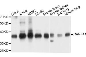 Western blot analysis of extract of various cells, using CAPZA1 antibody.