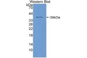 Western blot analysis of the recombinant protein. (Phospholamban 抗体  (AA 1-52))
