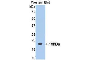Western blot analysis of the recombinant protein. (IL13 Receptor alpha 1 抗体  (AA 28-171))