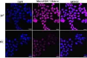 Immunocytochemical staining of HeLa cells using MacroH2A. (Recombinant Histone, H2A1, Macro 抗体)