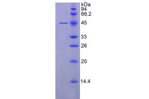 SDS-PAGE analysis of Human GPX4 Protein. (GPX4 蛋白)