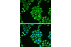 Immunofluorescence analysis of HeLa cell using EPPIN antibody. (Eppin 抗体)