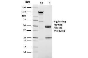 SDS-PAGE Analysis Purified Napsin A Mouse Monoclonal Antibody (NAPSA/3309). (NAPSA 抗体  (AA 189-299))