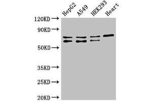 Western Blot Positive WB detected in: HepG2 whole cell lysate, A549 whole cell lysate, HEK293 whole cell lysate, Mouse heart tissue All lanes: HIF3A antibody at 2. (HIF3A 抗体  (AA 516-669))
