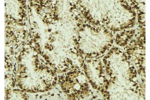 ABIN6273114 at 1/100 staining Human lung tissue by IHC-P. (DYX1C1 抗体)