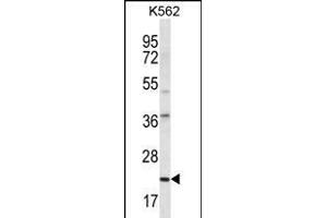 HLA-DQA1 Antibody (Center) (ABIN656168 and ABIN2845498) western blot analysis in K562 cell line lysates (35 μg/lane). (HLA-DQA1 抗体  (AA 57-84))