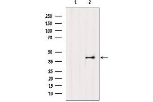 Western blot analysis of extracts from Mouse lung, using EDG3 Antibody. (S1PR3 抗体  (N-Term))