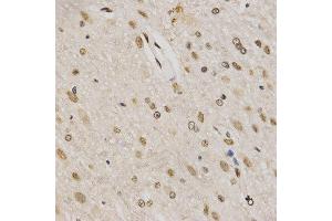 Immunohistochemistry of paraffin-embedded rat brain tissue using H3K79me3 antibody at dilution of 1:200 (x400 lens).