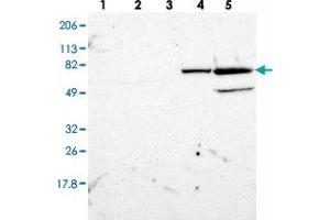 Western blot analysis of Lane 1: RT-4, Lane 2: U-251 MG, Lane 3: A-431, Lane 4: Liver, Lane 5: Tonsil with ZNF234 polyclonal antibody  at 1:250-1:500 dilution. (ZNF234 抗体)