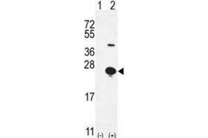 Western Blotting (WB) image for anti-Epithelial Mitogen (EPGN) antibody (ABIN2996100) (Epigen 抗体)