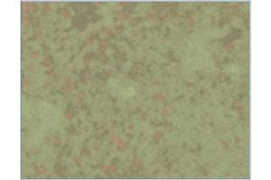 Immunohistochemistry analysis of Listeria infected mice spleens 6 days after infection with L-monocytogenes using AM03145PU (Clone LK2). (HSPD1 抗体)