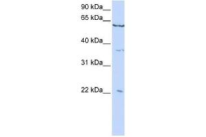 CSRP2 antibody used at 0. (CSRP2 抗体  (C-Term))