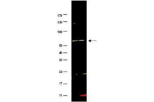Western blot using  affinity purified anti-FANCG antibody shows detection of a band at ~69 kDa (arrowhead) corresponding to FANCG present in a HeLa whole cell lysate. (FANCG 抗体  (AA 1-12))