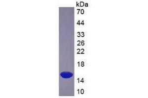 SDS-PAGE analysis of Human GLUT3 Protein. (SLC2A3 蛋白)